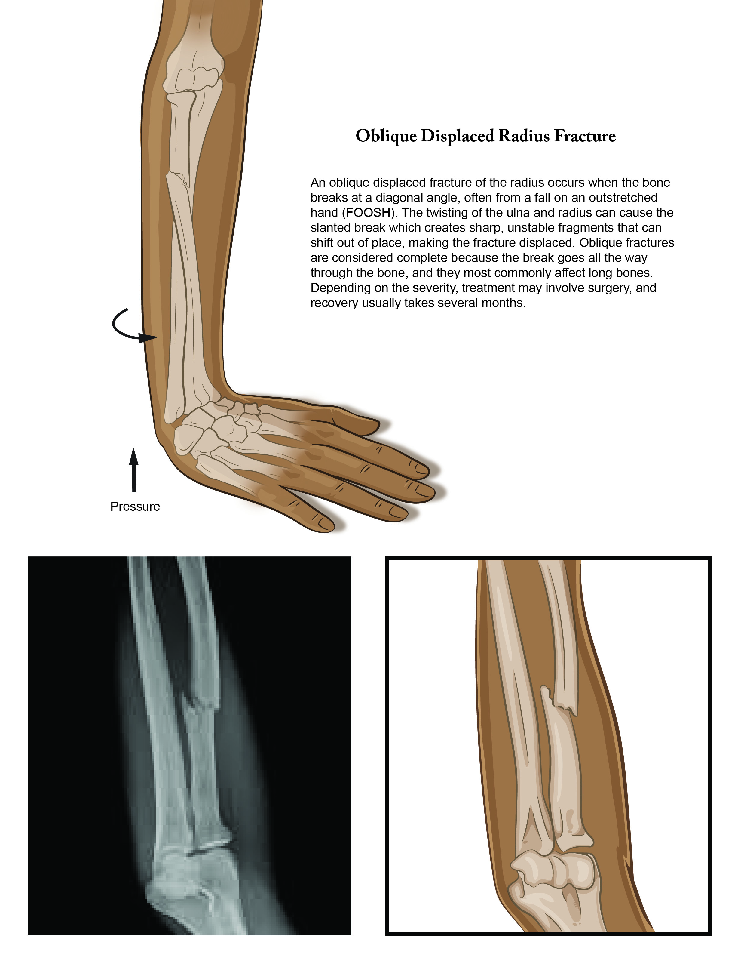Medical legal illustration