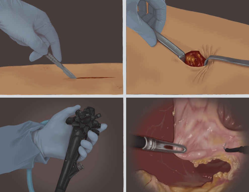 Surgical instruments in use