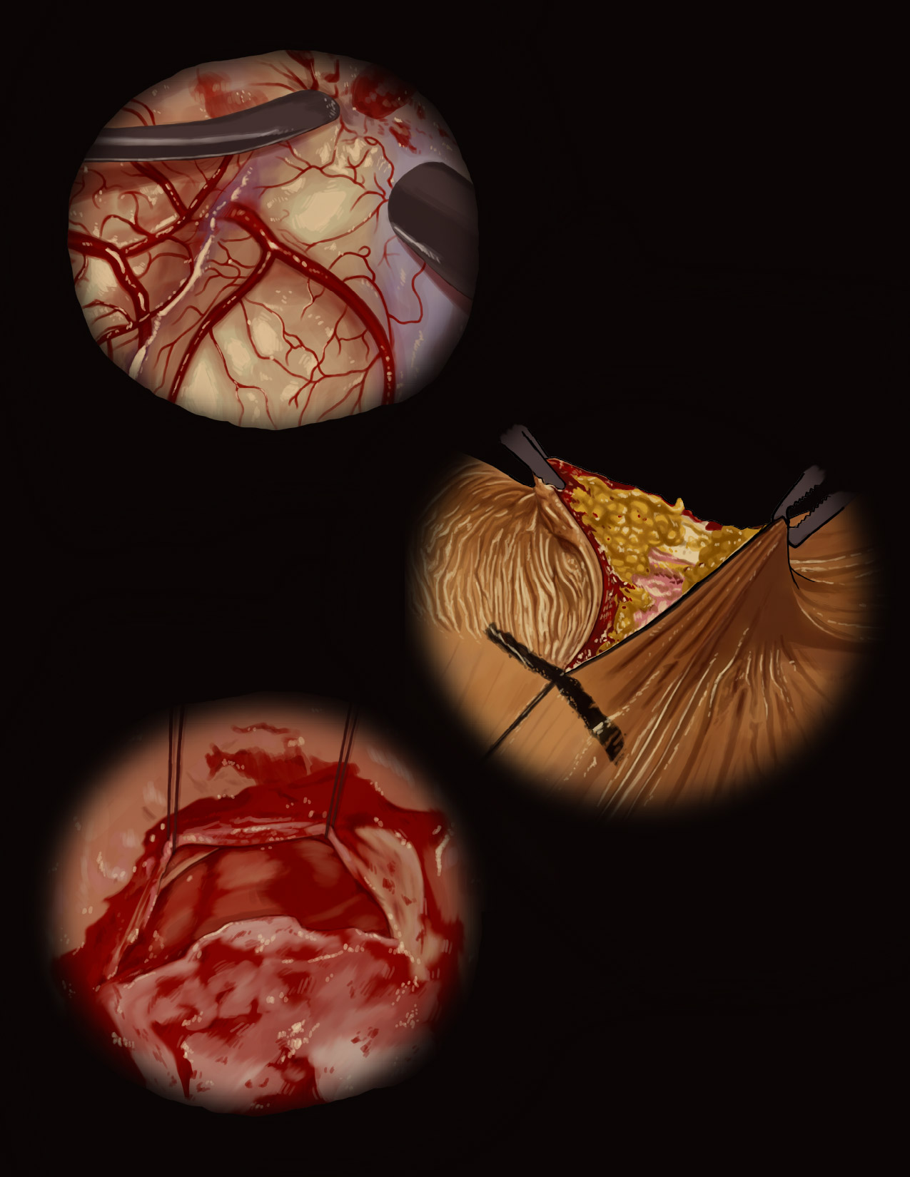 Study of veins, fascia, and adipose tissue